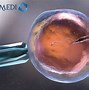 Bác Sĩ Ivf Giỏi Hà Nội